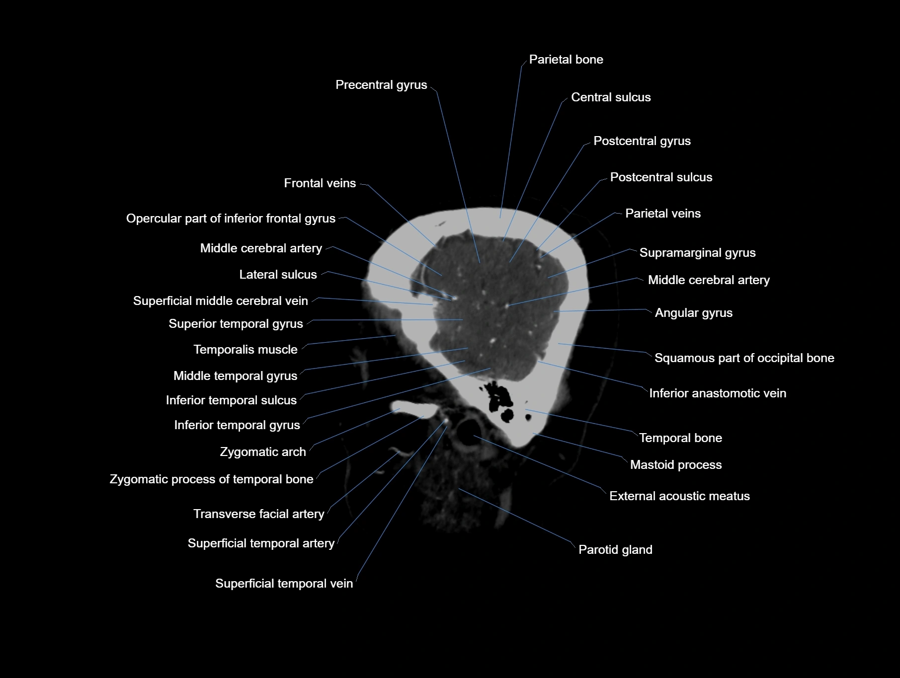 CT scan brain sagittal cross sectional anatomy image-img-00001-00009.webp